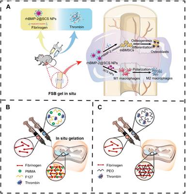 Smart responsive in situ hydrogel systems applied in bone tissue engineering